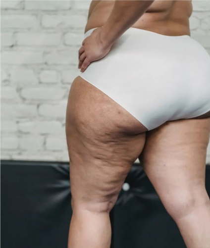 top0002